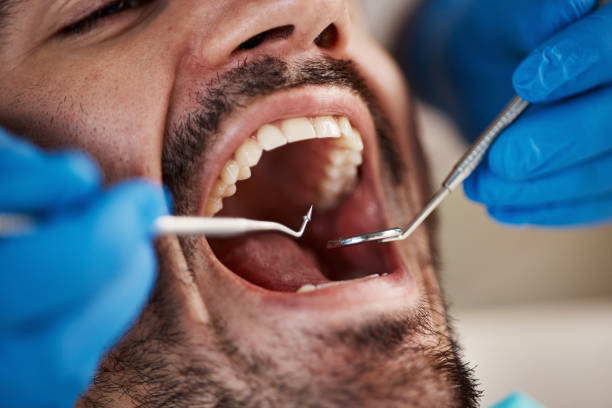 Best Walk-In Emergency Dentist in Lakeway, TX